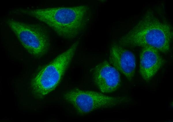 3 - Anti-EPRS1/PARS Antibody Picoband™ (monoclonal, 12B5B3) ABO15114