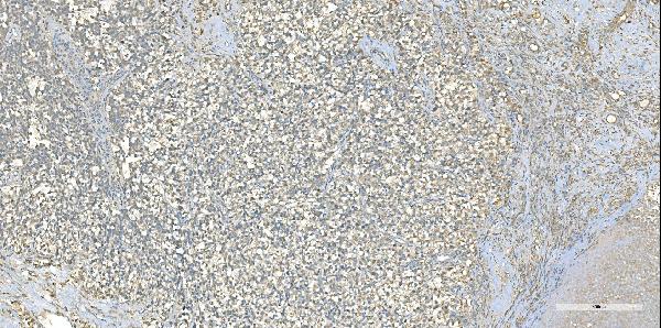 2 - Anti-EPRS1/PARS Antibody Picoband™ (monoclonal, 12B5B3) ABO15114