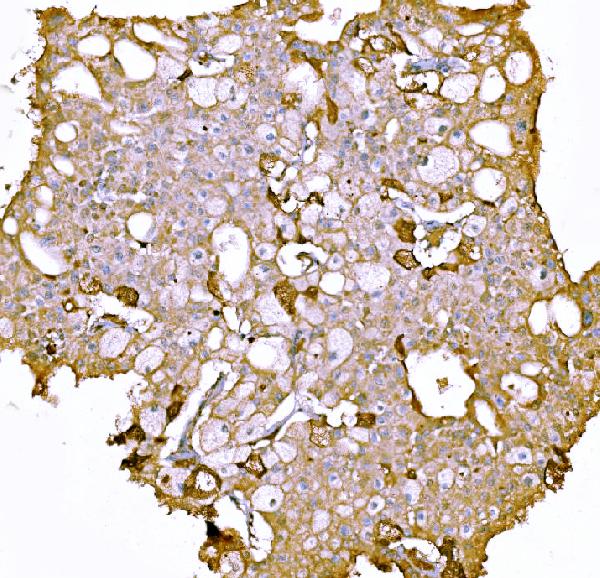 2 - Anti-Prothrombin Antibody Picoband™ (monoclonal, 4G13G9) ABO15116