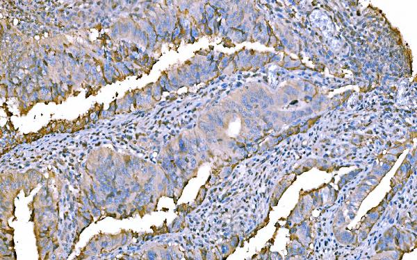 2 - Anti-Prothrombin Antibody Picoband™ (monoclonal, 4G13G9) ABO15116