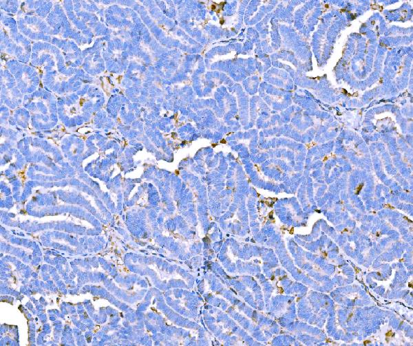 2 - Anti-Prothrombin Antibody Picoband™ (monoclonal, 4G13G9) ABO15116