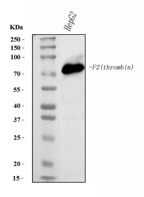 1 - Anti-Prothrombin Antibody Picoband™ (monoclonal, 4G13G9) ABO15116