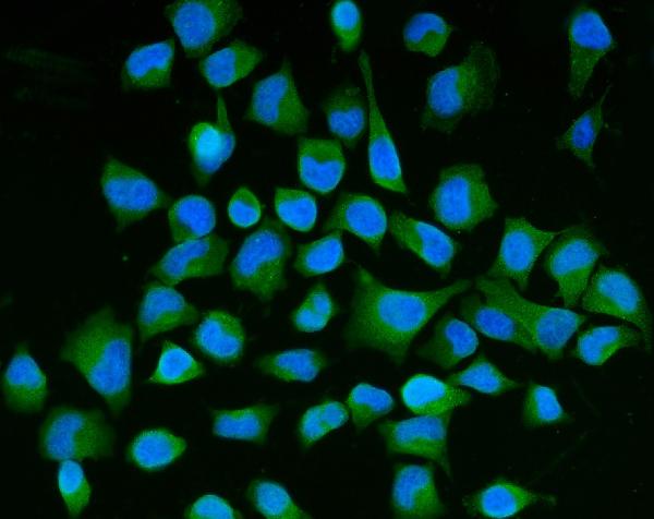 3 - Anti-Semaphorin 3B/SEMA3B Antibody Picoband™ (monoclonal, 9C4F7) ABO15117