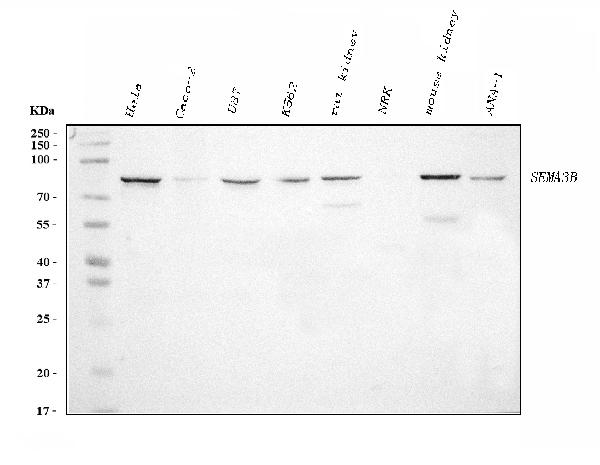 1 - Anti-Semaphorin 3B/SEMA3B Antibody Picoband™ (monoclonal, 9C4F7) ABO15117