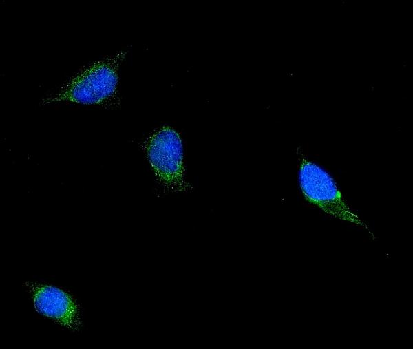 3 - Anti-Filamin B/FLNB Antibody Picoband™ (monoclonal, 11E2D2) ABO15118