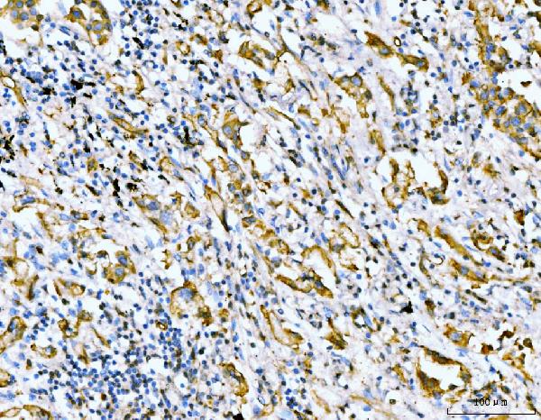 2 - Anti-Filamin B/FLNB Antibody Picoband™ (monoclonal, 11E2D2) ABO15118
