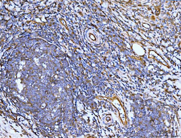 2 - Anti-Filamin B/FLNB Antibody Picoband™ (monoclonal, 11E2D2) ABO15118