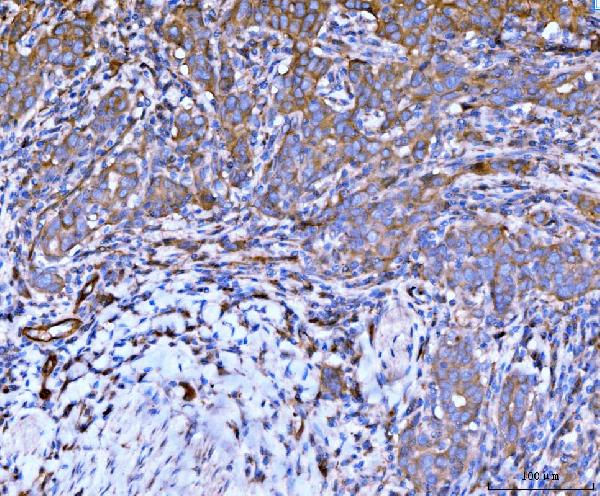 2 - Anti-Filamin B/FLNB Antibody Picoband™ (monoclonal, 11E2D2) ABO15118