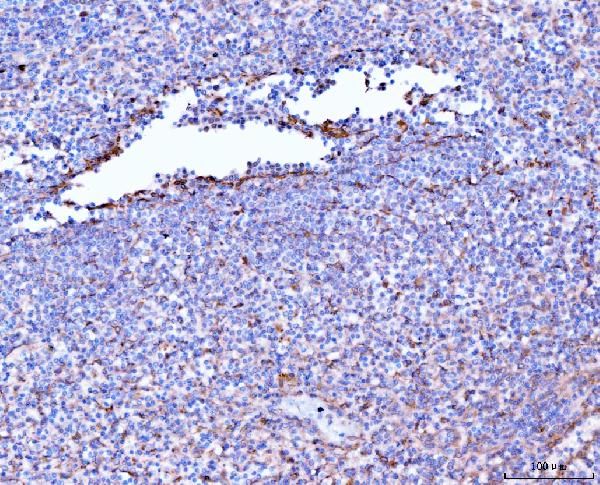 2 - Anti-Filamin B/FLNB Antibody Picoband™ (monoclonal, 11E2D2) ABO15118