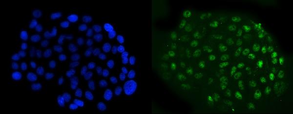 3 - Anti-NFIB/NF1B2 Antibody Picoband™ (monoclonal, 4D6E4) ABO15119