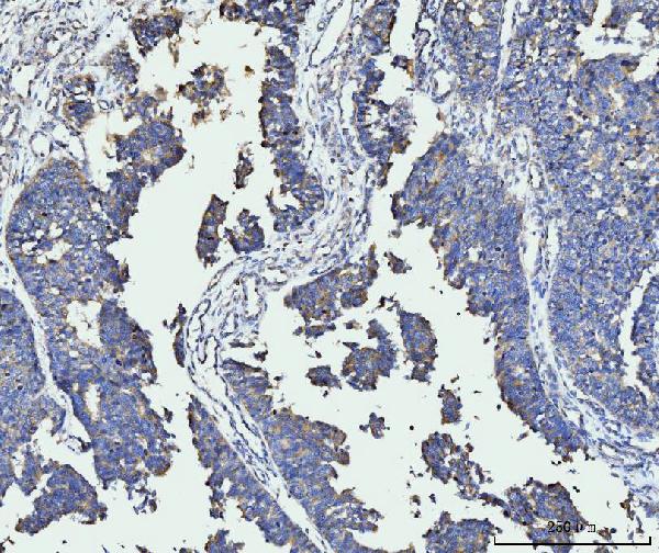 2 - Anti-FACL4/ACSL4 Antibody Picoband™ (monoclonal, 4I7) ABO15120