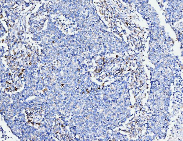 2 - Anti-FACL4/ACSL4 Antibody Picoband™ (monoclonal, 4I7) ABO15120