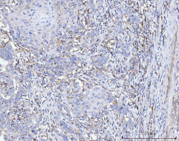 2 - Anti-FACL4/ACSL4 Antibody Picoband™ (monoclonal, 4I7) ABO15120