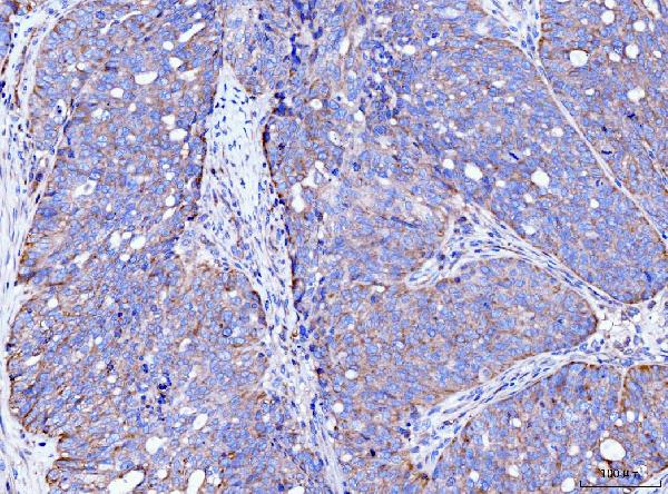 2 - Anti-FACL4/ACSL4 Antibody Picoband™ (monoclonal, 4I7) ABO15120