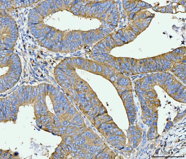 2 - Anti-FACL4/ACSL4 Antibody Picoband™ (monoclonal, 4I7) ABO15120