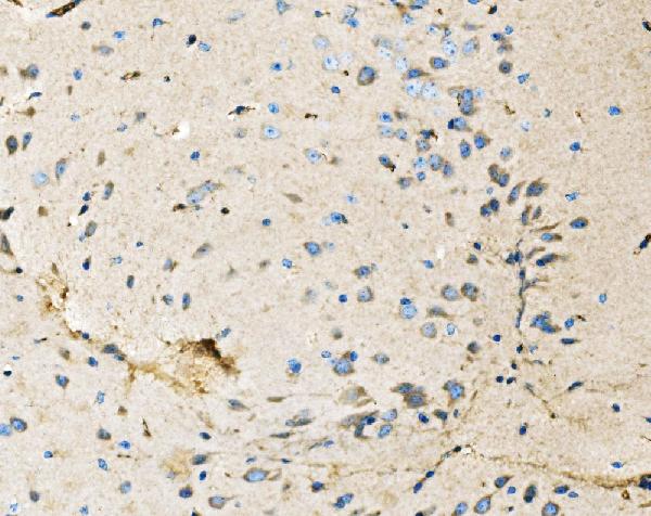 2 - Anti-Neurofibromin/NF1 Antibody Picoband™ (monoclonal, 4C6F10) ABO15121