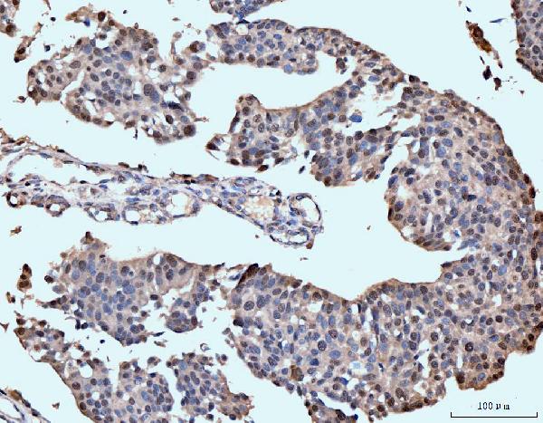 2 - Anti-Neurofibromin/NF1 Antibody Picoband™ (monoclonal, 4C6F10) ABO15121