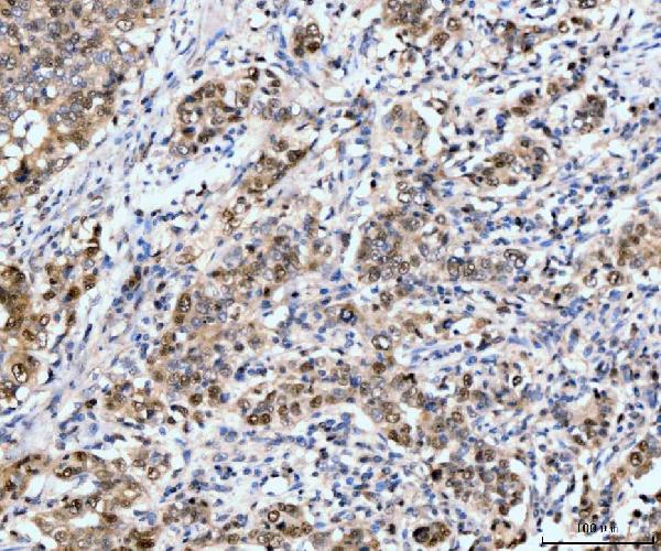 2 - Anti-Neurofibromin/NF1 Antibody Picoband™ (monoclonal, 4C6F10) ABO15121