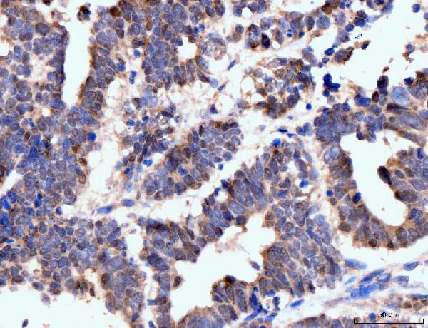 2 - Anti-Neurofibromin/NF1 Antibody Picoband™ (monoclonal, 4C6F10) ABO15121