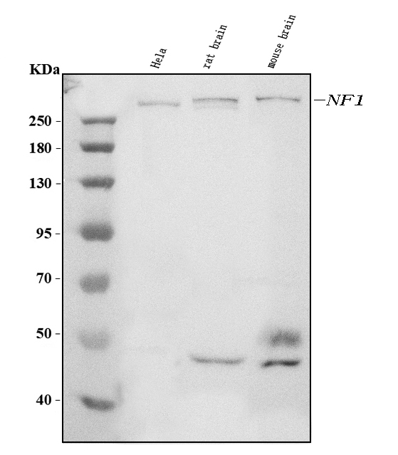 1 - Anti-Neurofibromin/NF1 Antibody Picoband™ (monoclonal, 4C6F10) ABO15121