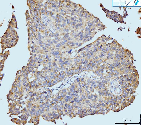 2 - Anti-Neurofibromin/NF1 Antibody Picoband™ (monoclonal, 4F8B7) ABO15122