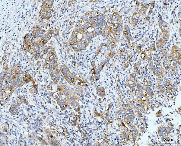 2 - Anti-Neurofibromin/NF1 Antibody Picoband™ (monoclonal, 4F8B7) ABO15122