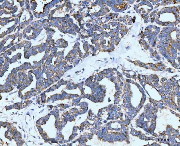 2 - Anti-Neurofibromin/NF1 Antibody Picoband™ (monoclonal, 4F8B7) ABO15122