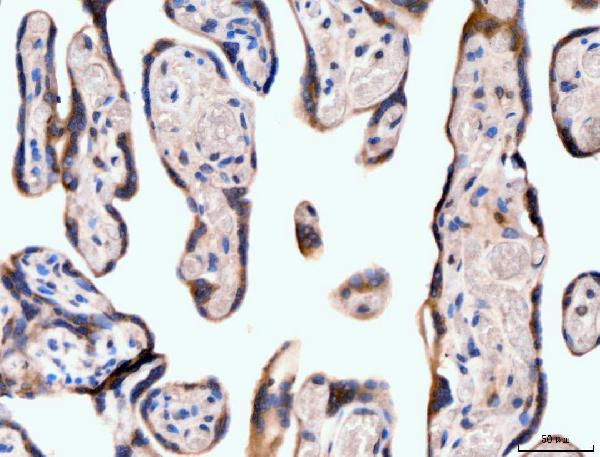 2 - Anti-Neurofibromin/NF1 Antibody Picoband™ (monoclonal, 4F8B7) ABO15122