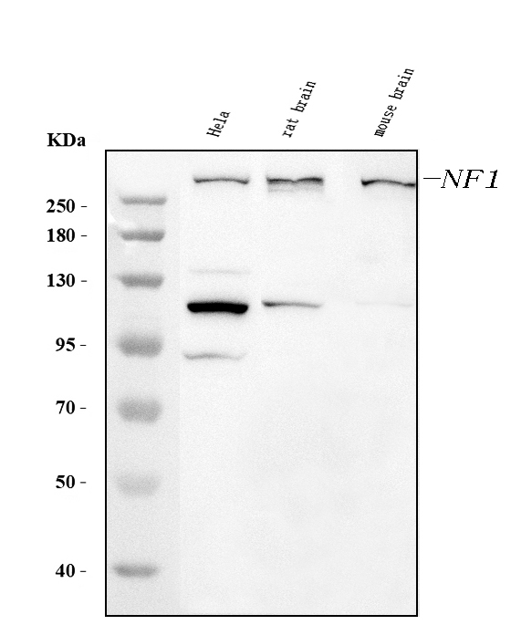 1 - Anti-Neurofibromin/NF1 Antibody Picoband™ (monoclonal, 4F8B7) ABO15122