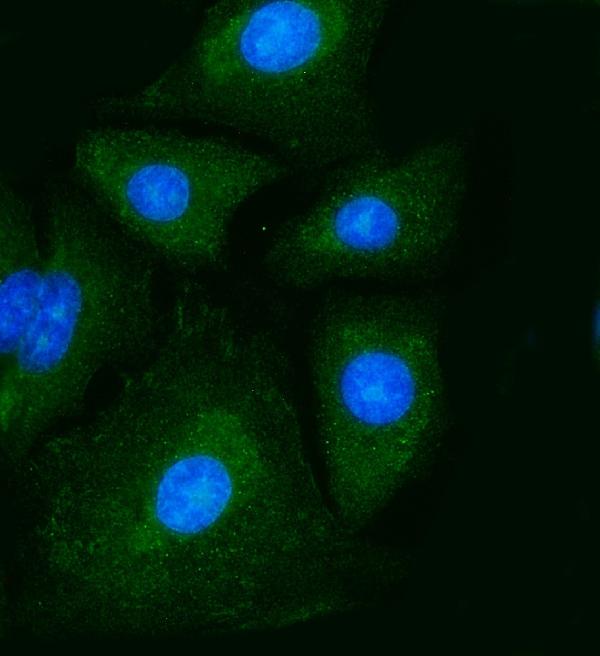 3 - Anti-PKM2 Antibody Picoband™ (monoclonal, 11I4C3) ABO15123