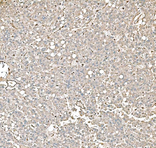 2 - Anti-PKM2 Antibody Picoband™ (monoclonal, 11I4C3) ABO15123