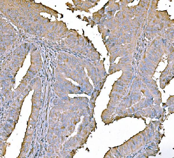 2 - Anti-PKM2 Antibody Picoband™ (monoclonal, 11I4C3) ABO15123
