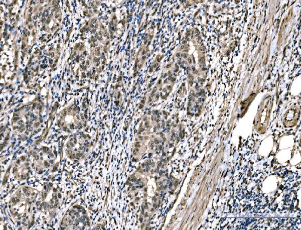 2 - Anti-DYNLL1/PIN Antibody Picoband™ (monoclonal, 6G2H1) ABO15125