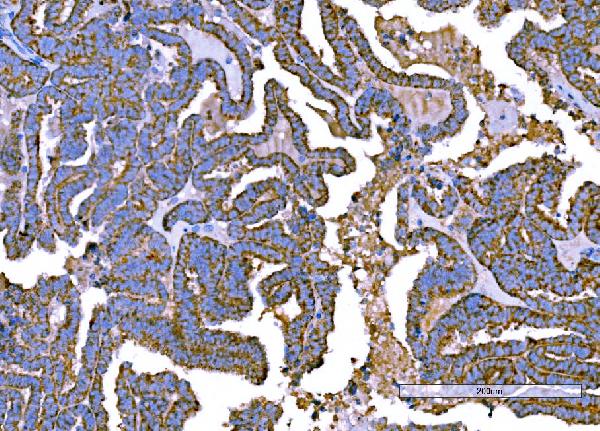 2 - Anti-RALBP1 Antibody Picoband™ (monoclonal, 2F9D3) ABO15126