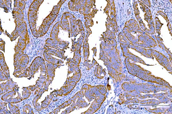 2 - Anti-RALBP1 Antibody Picoband™ (monoclonal, 2F9D3) ABO15126