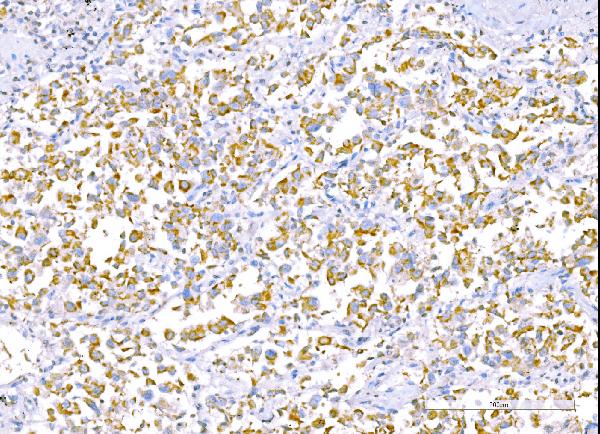 2 - Anti-RALBP1 Antibody Picoband™ (monoclonal, 2F9D3) ABO15126