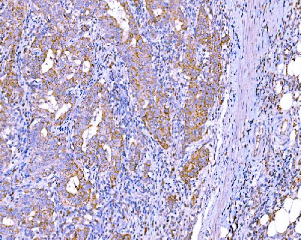 2 - Anti-RALBP1 Antibody Picoband™ (monoclonal, 2F9D3) ABO15126