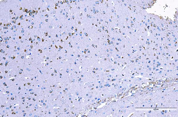 2 - Anti-RALBP1 Antibody Picoband™ (monoclonal, 2F9D3) ABO15126