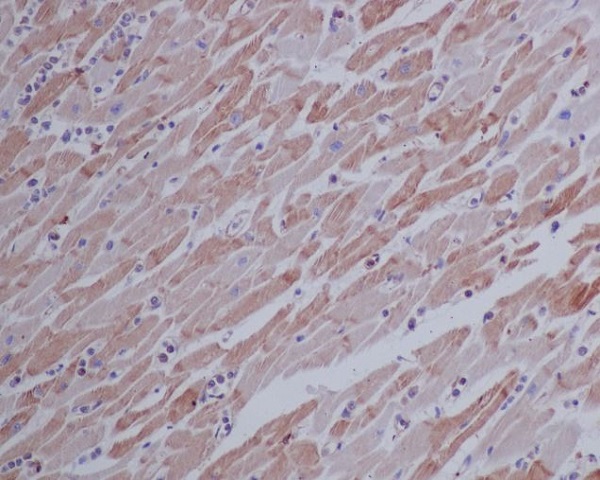2 - Anti-beta Actin Mouse Monoclonal Antibody ABO15135