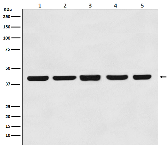 1 - Anti-beta Actin Mouse Monoclonal Antibody ABO15135