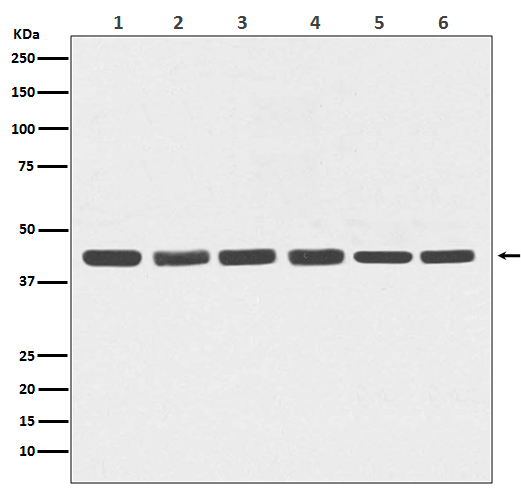 1 - Anti-beta Actin Mouse Monoclonal Antibody ABO15136