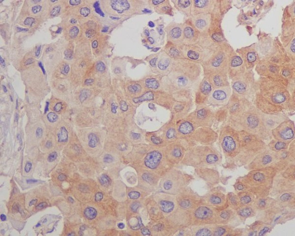 2 - Anti-beta Tubulin Mouse Monoclonal Antibody ABO15138