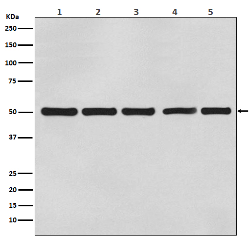 1 - Anti-beta Tubulin Mouse Monoclonal Antibody ABO15138