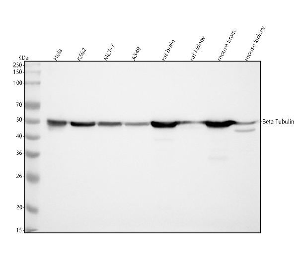 1 - Anti-beta Tubulin Mouse Monoclonal Antibody ABO15138