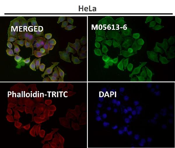 1 - Anti-beta Tubulin Rabbit Monoclonal Antibody ABO15140