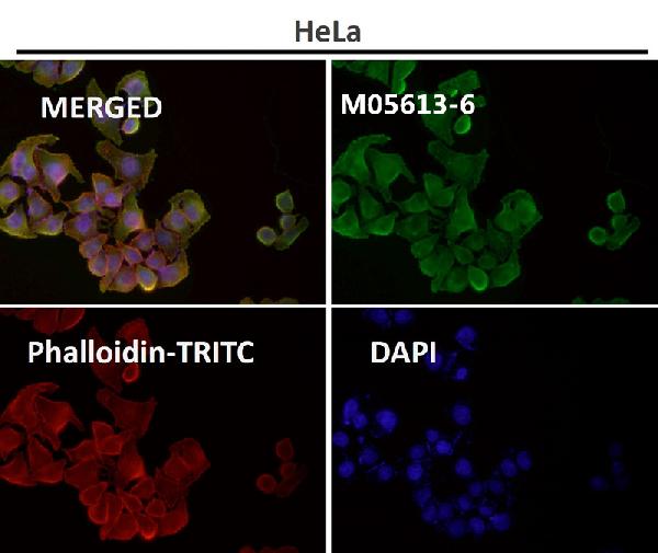 1 - Anti-beta Tubulin Rabbit Monoclonal Antibody ABO15140