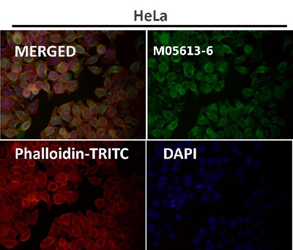 1 - Anti-beta Tubulin Rabbit Monoclonal Antibody ABO15140