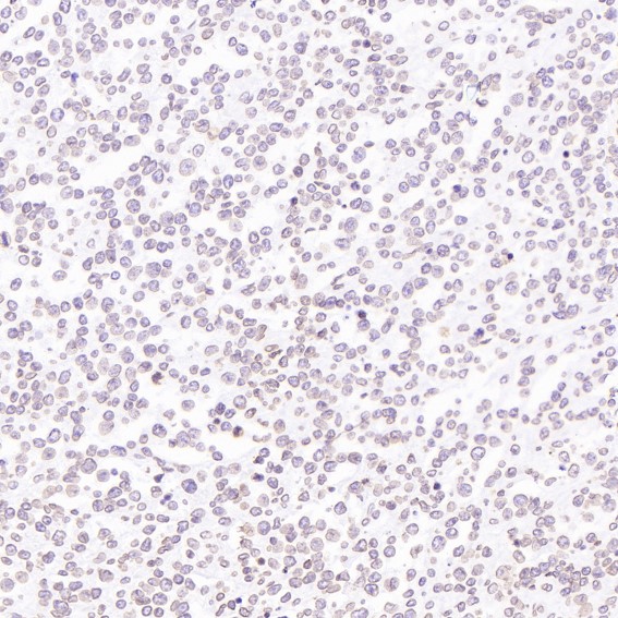 2 - Anti-beta Tubulin Rabbit Monoclonal Antibody ABO15140