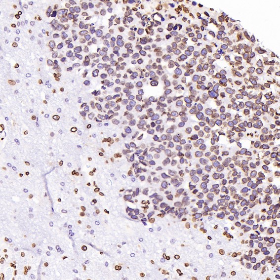 2 - Anti-beta Tubulin Rabbit Monoclonal Antibody ABO15140