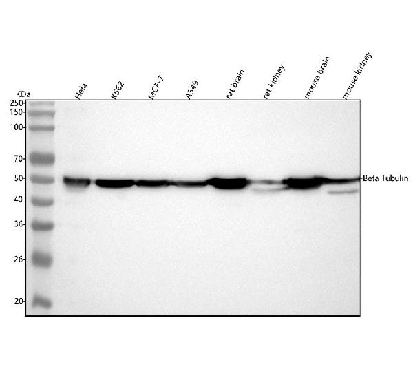 1 - Anti-beta Tubulin Rabbit Monoclonal Antibody ABO15140
